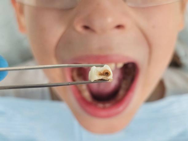 Best Emergency Dentist for Knocked-Out Tooth in Atoka, TN